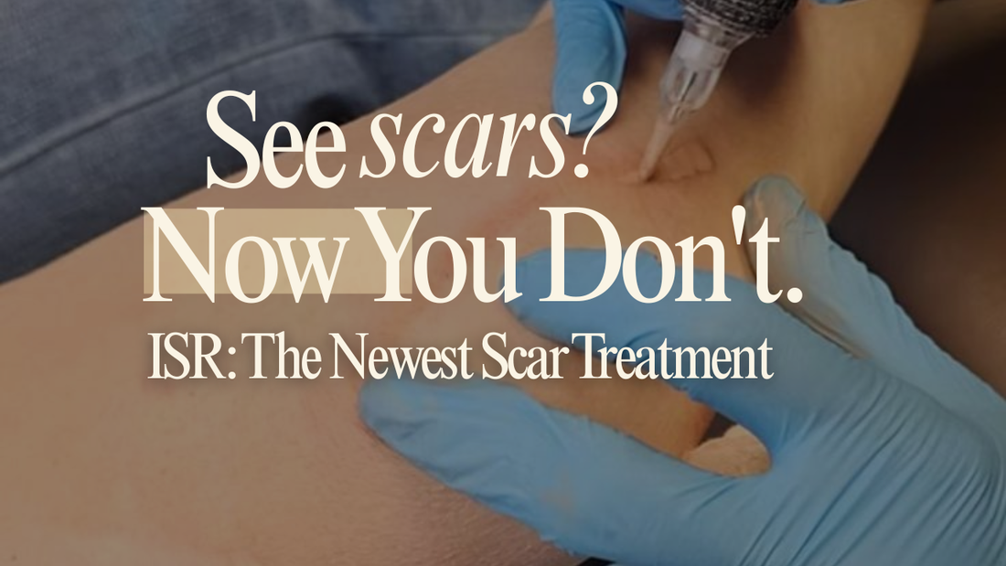 ISR : The Newest Scar Treatment Redefining Skin Confidence in Edmonton | Dermillusion