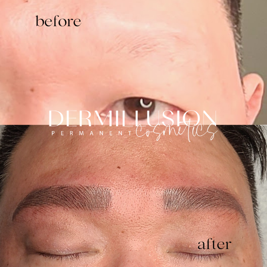Man Brows MEN – THE BEAUTY CO | DERMILLUSION